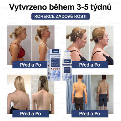 💧Voilaist® Kyselina Salicylová Gel pro úlevu od bolesti kloubů - (snižuje otoky kloubů, bolest, ztuhlost, zarudnutí, teplo, bolestivost a únavu kloubů), obsahuje 4% kyseliny salicylové, glukosamin, MSM, arniku, chondroitin, vitamín K2