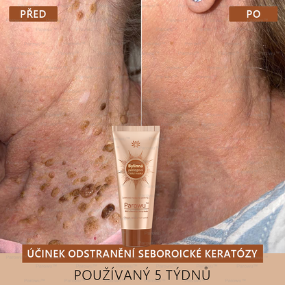 Parowu™ Bělící a Odstraňující Skvrny Maska -Přírodní složky trvale odstraňují pigmentové skvrny, stařecké skvrny, pihy a sluneční skvrny.