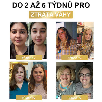 🔥50% sleva - [CE Certifikace] 🐝XRLXRL™ Méhméreg Lymphatic Detox Hubnoucí Náplast