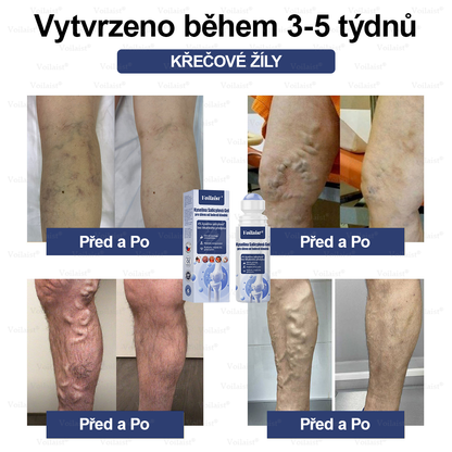 💧Voilaist® Kyselina Salicylová Gel pro úlevu od bolesti kloubů - (snižuje otoky kloubů, bolest, ztuhlost, zarudnutí, teplo, bolestivost a únavu kloubů), obsahuje 4% kyseliny salicylové, glukosamin, MSM, arniku, chondroitin, vitamín K2