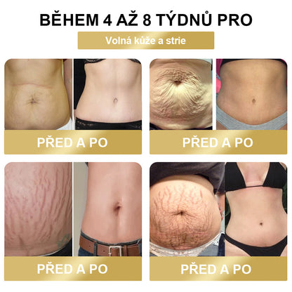 🔥50% sleva - [CE Certifikace] 🐝XRLXRL™ Méhméreg Lymphatic Detox Hubnoucí Náplast