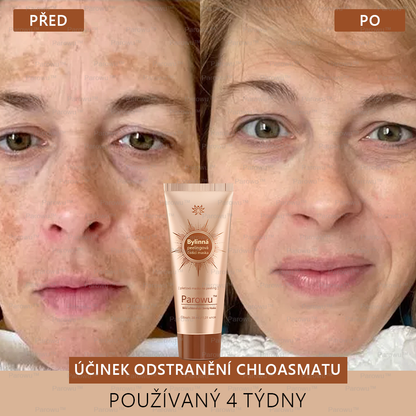 Parowu™ Bělící a Odstraňující Skvrny Maska -Přírodní složky trvale odstraňují pigmentové skvrny, stařecké skvrny, pihy a sluneční skvrny.